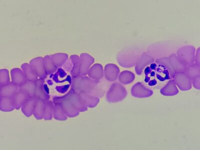 anaplasma inclusions