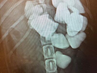 gastric foreign body in DV