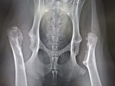 bilateral femoral head ostectomy - years after procedure